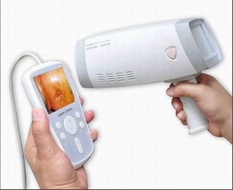 Colposcope cervical tenu dans la main d'appareil-photo de Digital pour que la gynécologie inspecte le cervix avec 80,0000 le bourdonnement de la résolution 1~128 de pixels