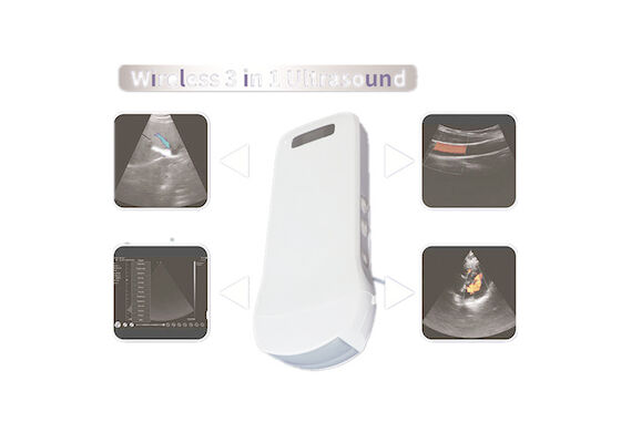Scanner d'ultrason de Doppler de couleur d'échographie de Doppler de couleur avec le signal intégré 2.5MHz~10MHz de remplissage sans fil Freq de WiFi