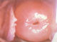 Colposcope cervical tenu dans la main d'appareil-photo de Digital pour que la gynécologie inspecte le cervix avec 80,0000 le bourdonnement de la résolution 1~128 de pixels