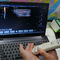 Scanner tenu dans la main d'ultrason de couleur de machine portative de Doppler avec la fréquence 2~11MHz