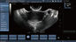 Scanner Transvaginal d'ultrason de Doppler de couleur de sonde, grossesse tenue dans la main de Doppler