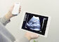 Logiciel diagnostique de téléchargement d'équipement d'ultrason de Doppler de couleur d'ultrason d'App Store ou Google Play 3 dans 1 radio