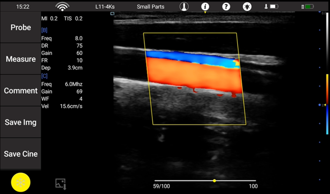 Sonde cardiaque linéaire convexe d'ultrason de sonde de sonde sans fil Transvaginal d'ultrason détachable